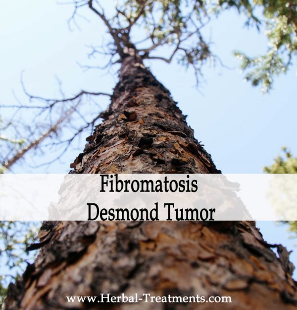 Herbal Medicine for Aggressive Fibromatosis - Desmond Tumor Recovery & Prevention