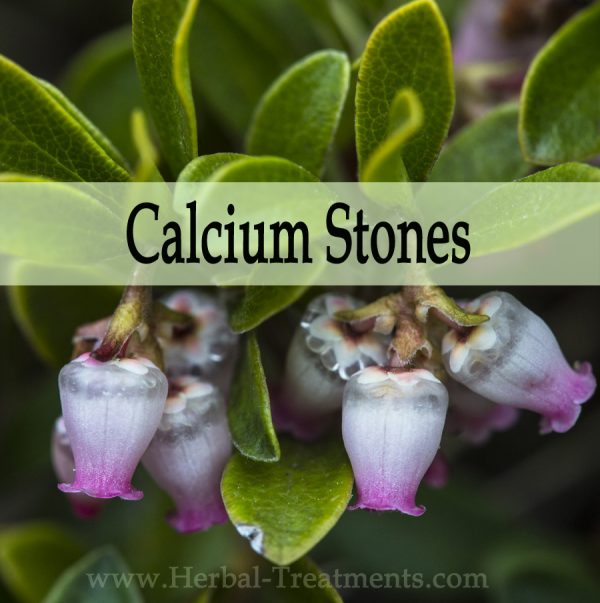 Herbal Medicine for Calcium Stones