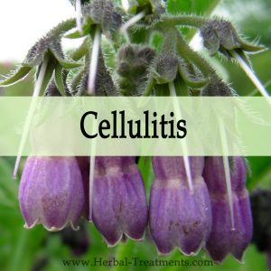 Herbal Medicine for Cellulitis