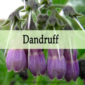 Herbal Medicine for Dandruff
