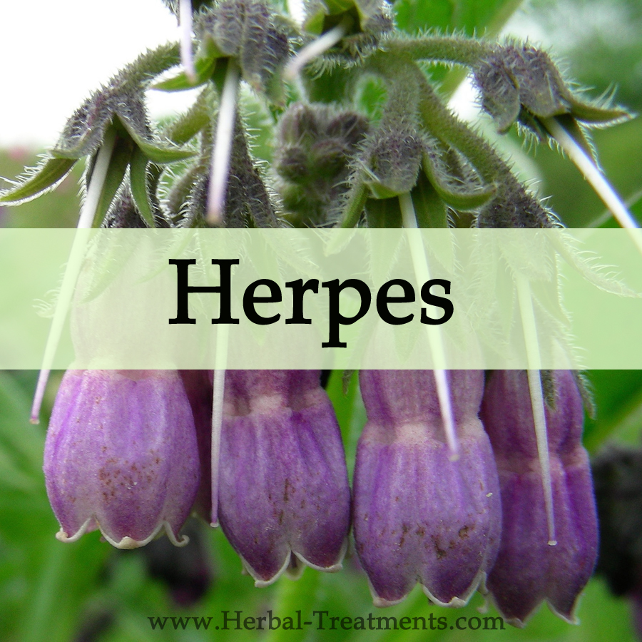 herpes-virus-herbal-medicine
