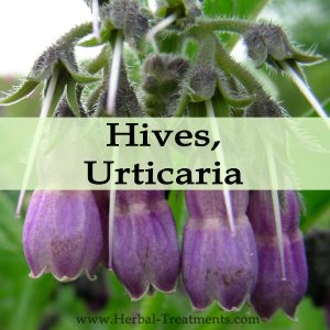 Herbal Medicine for Hives or Urticaria