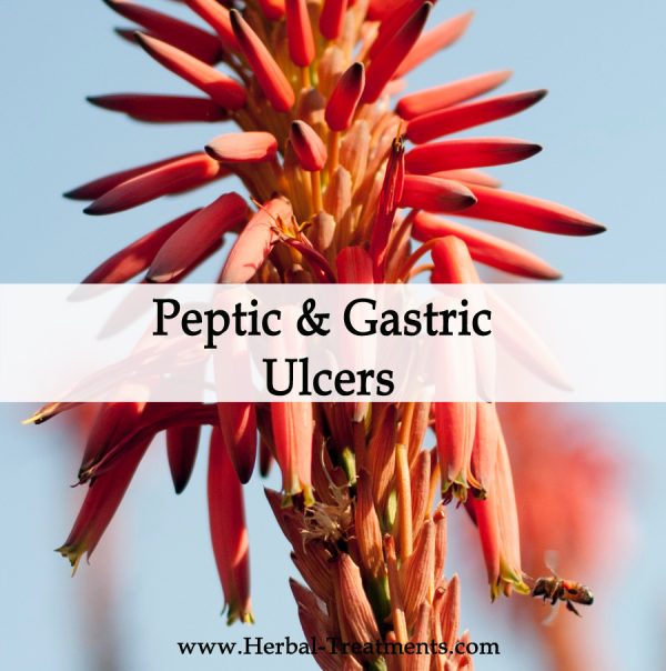Herbal Medicine for Peptic and Gastric Ulcers
