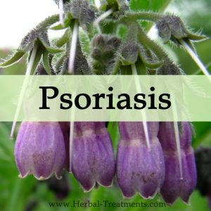 Herbal Medicine for Psoriasis