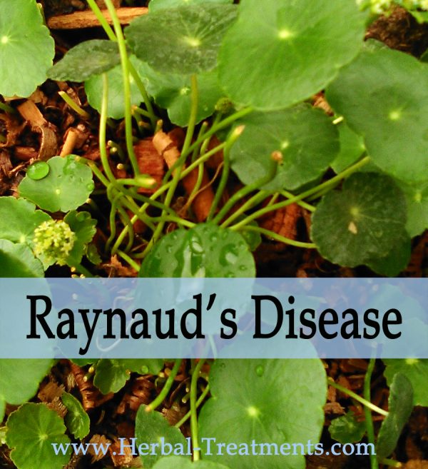 Herbal Treatment of Raynaud's Disease