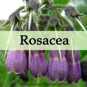Herbal Medicine for Rosacea