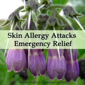 Herbal Medicine for Skin Allergy Attacks, Irritation - Emergency Relief