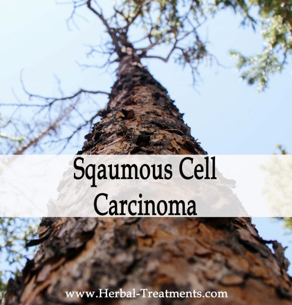 Herbal Medicine for Sqaumous Cell Carcinoma Recovery & Prevention