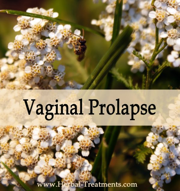 Herbal Medicine for Vaginal Prolapse Herbal Treatment