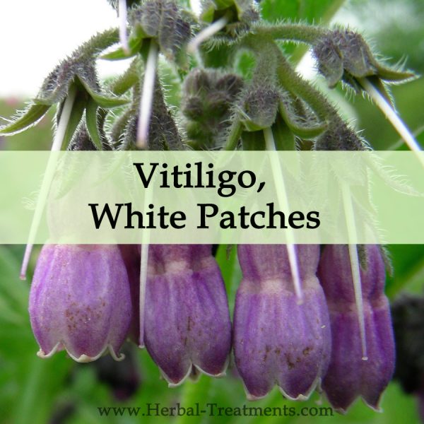 Herbal Medicine for Vitiligo, Leucoderma White Patches